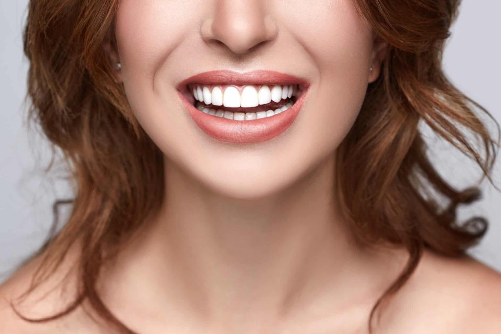 Porcelain Veneers Procedure and Care