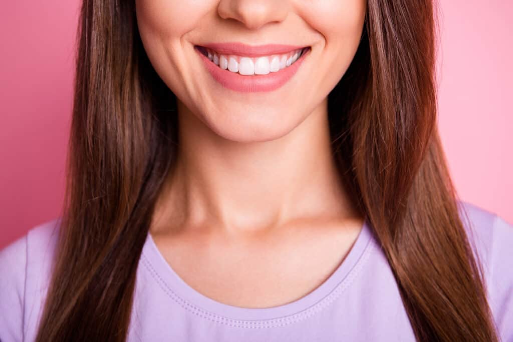 Dental Veneers: 4 Types (Pros and Cons)