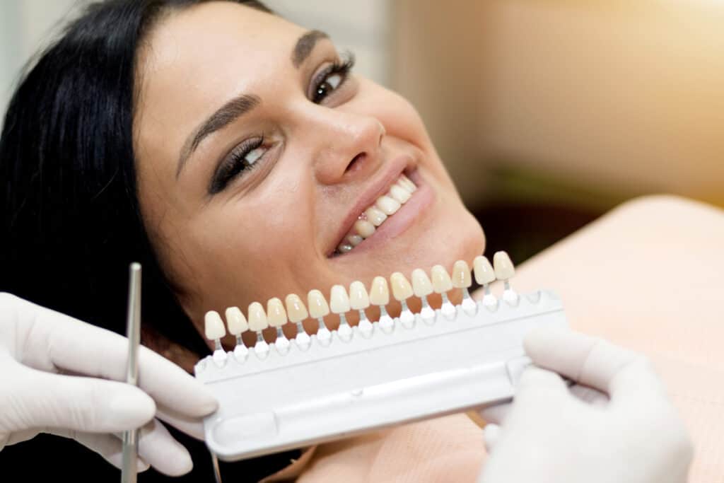 Veneers Questions and Answers