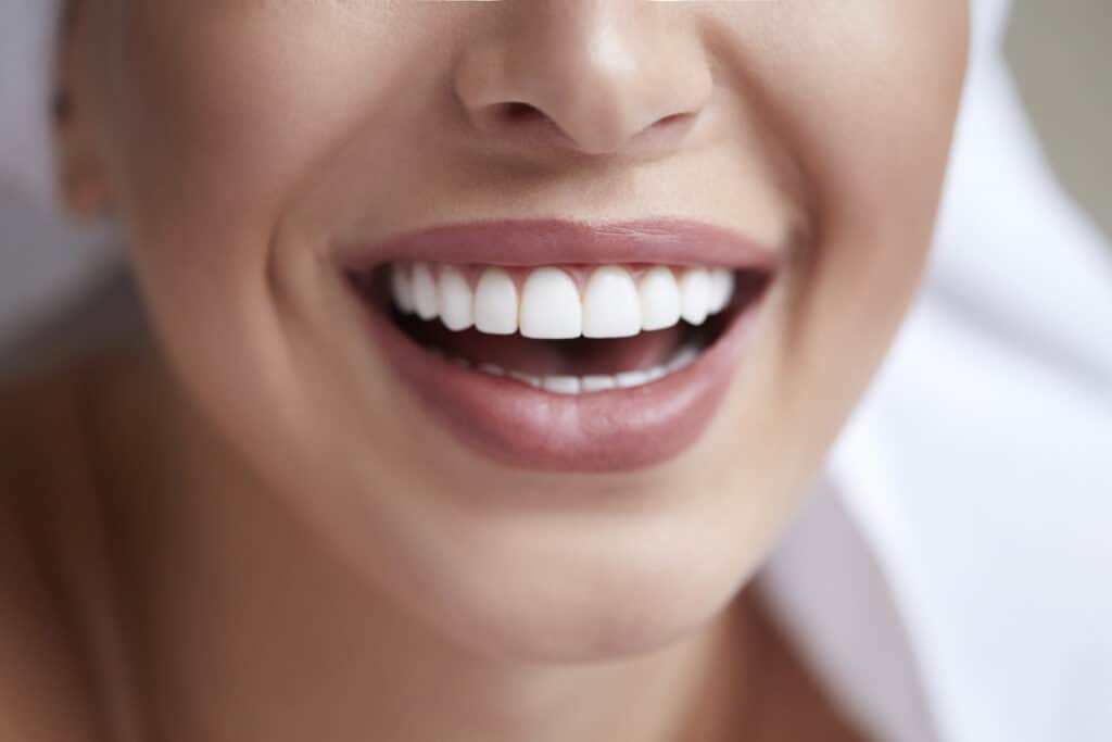 Porcelain Veneers vs. Composite Veneers: What’s the Difference?